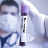 COVID-19 Coronavirus